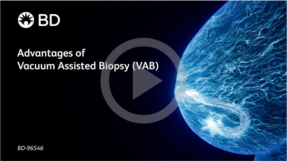 Advantages of Vacuum Assisted Biopsy (VAB) Video
