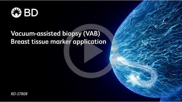 Video about Vacuum assisted biopsy (VAB): Breast tissue marker application Tomosynthesis Biopsy exam Video