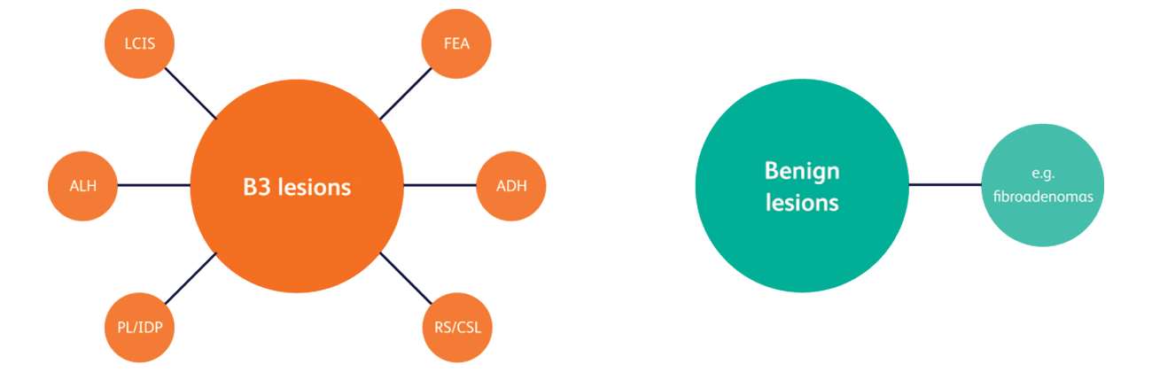 Diagram showing types of lesions treatable with vacuum-assisted excision. This includes the following B3 lesions: atypical ductal hyperplasia, atypical lobular hyperplasia, flat epithelial atypia, intraductal papilloma, lobular carcinoma in situ, papillary lesion, and radial scar/complex sclerosing lesion. Benign lesions are also treatable with VAB, such as fibroadenomas.
