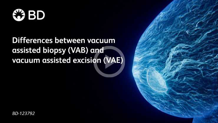 Differences between vacuum assisted biopsy (VAB) and vacuum assisted excision (VAE)