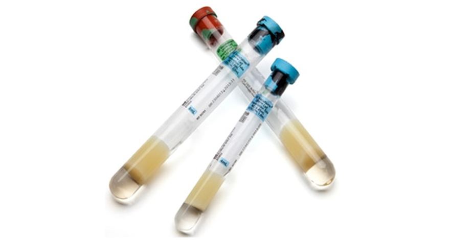 Cell Preparation Tubes (CPT™)